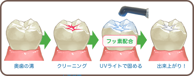 タエ小児歯科